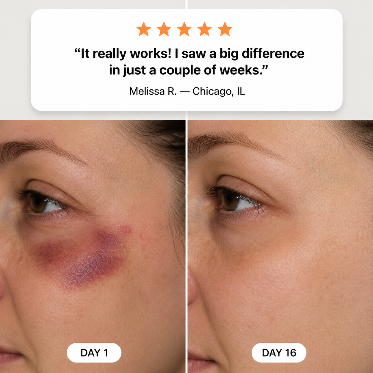 💥100K+ SOLD💕- LUMIVO® Bruise Repair & Skin-Strengthening Cream
