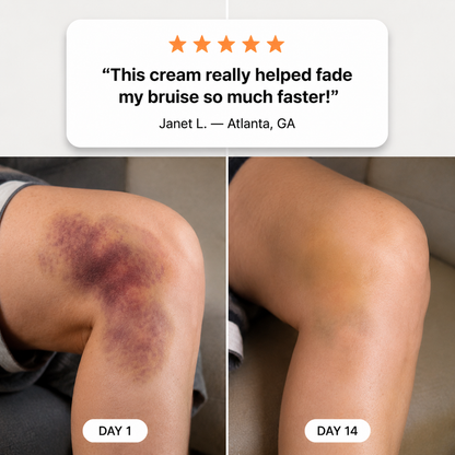 💥100K+ SOLD💕- LUMIVO® Bruise Repair & Skin-Strengthening Cream
